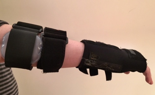My arm with a carpal tunnel brace and two tendinitis braces