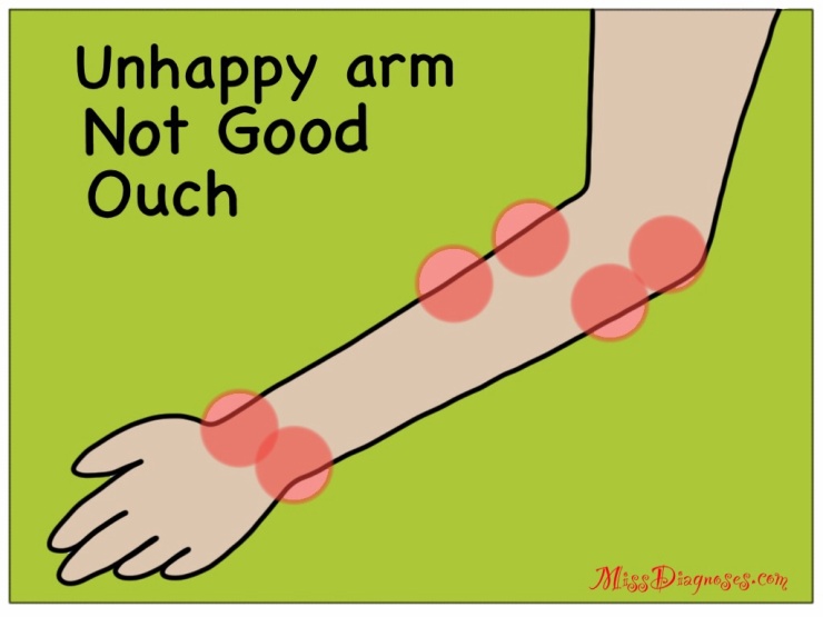 Drawing of arm with red dots showing where pain is