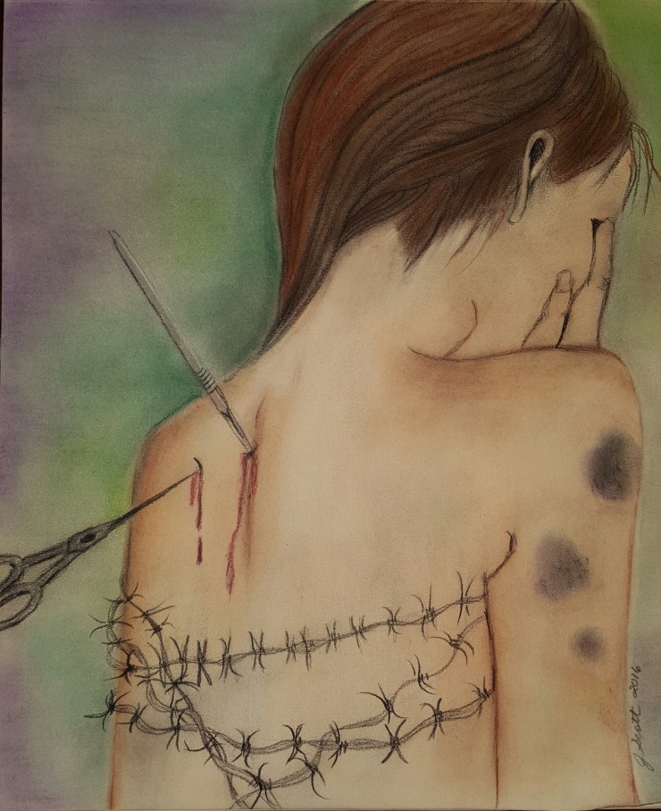 Expressions of Lyme 2